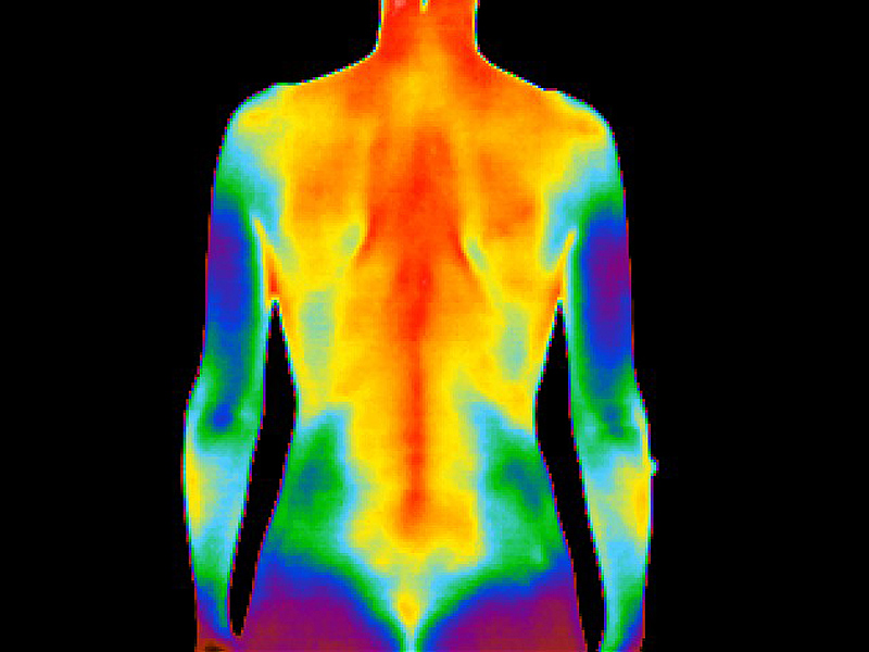 Thermogram
