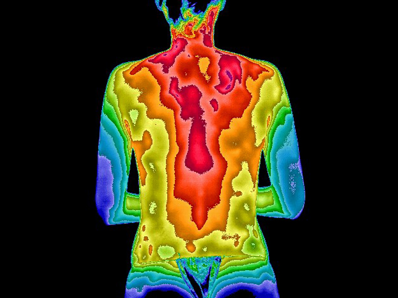 thermogram of back